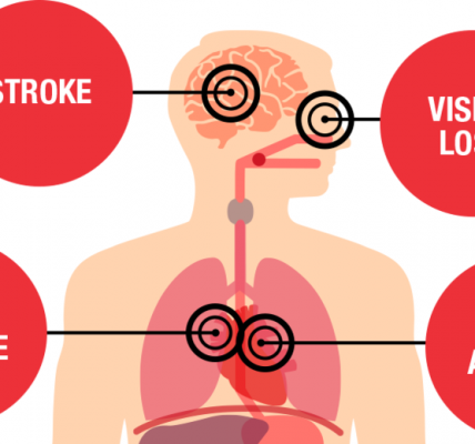 Hypertension The Silent Killer