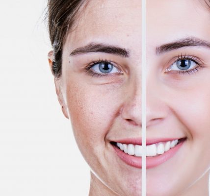 Anti-Aging Secrets to a Youthful Glow