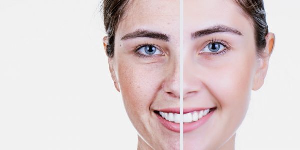 Anti-Aging Secrets to a Youthful Glow